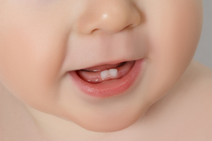 ӰأҪ׼ʲôƷ